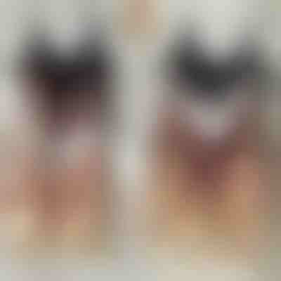 Varrás nélküli melltartó szett | BRAPACK