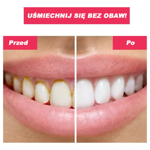 TOOTHCLEANSO
